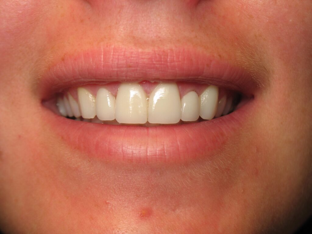 After Image: Restorative - front