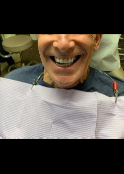 Dental Implants – Case 9