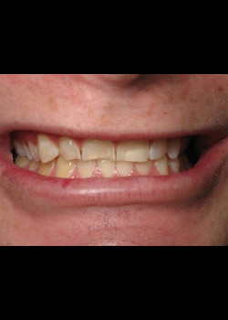 Cosmetic Dentistry – Case 3